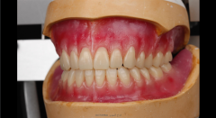 تقنية الاسنان